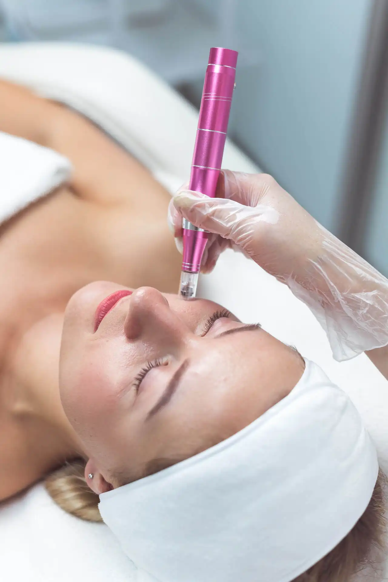 Micro-Needling Benefits