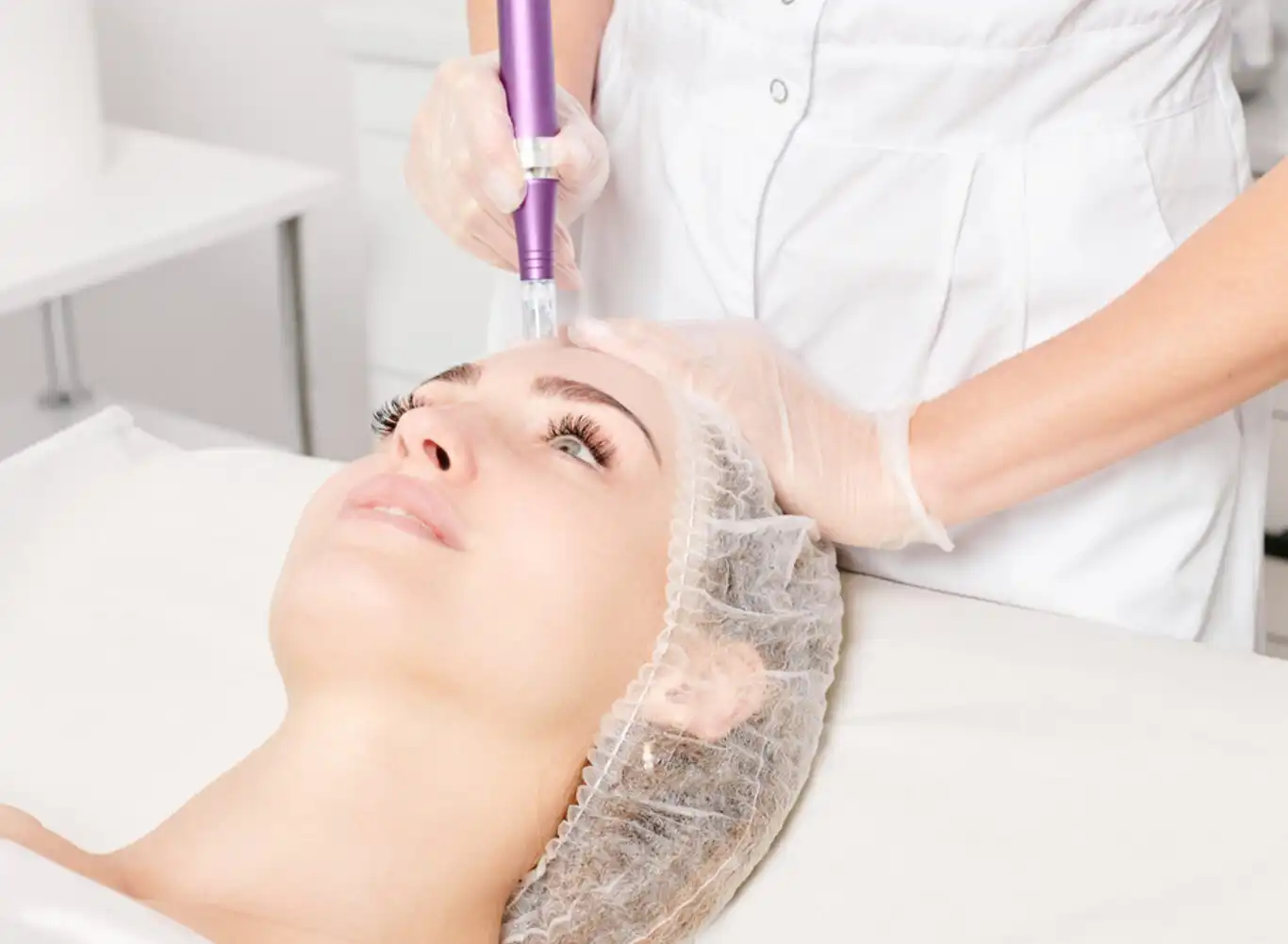 Micro-Needling: Your Ultimate Guide to Rejuvenated Skin
