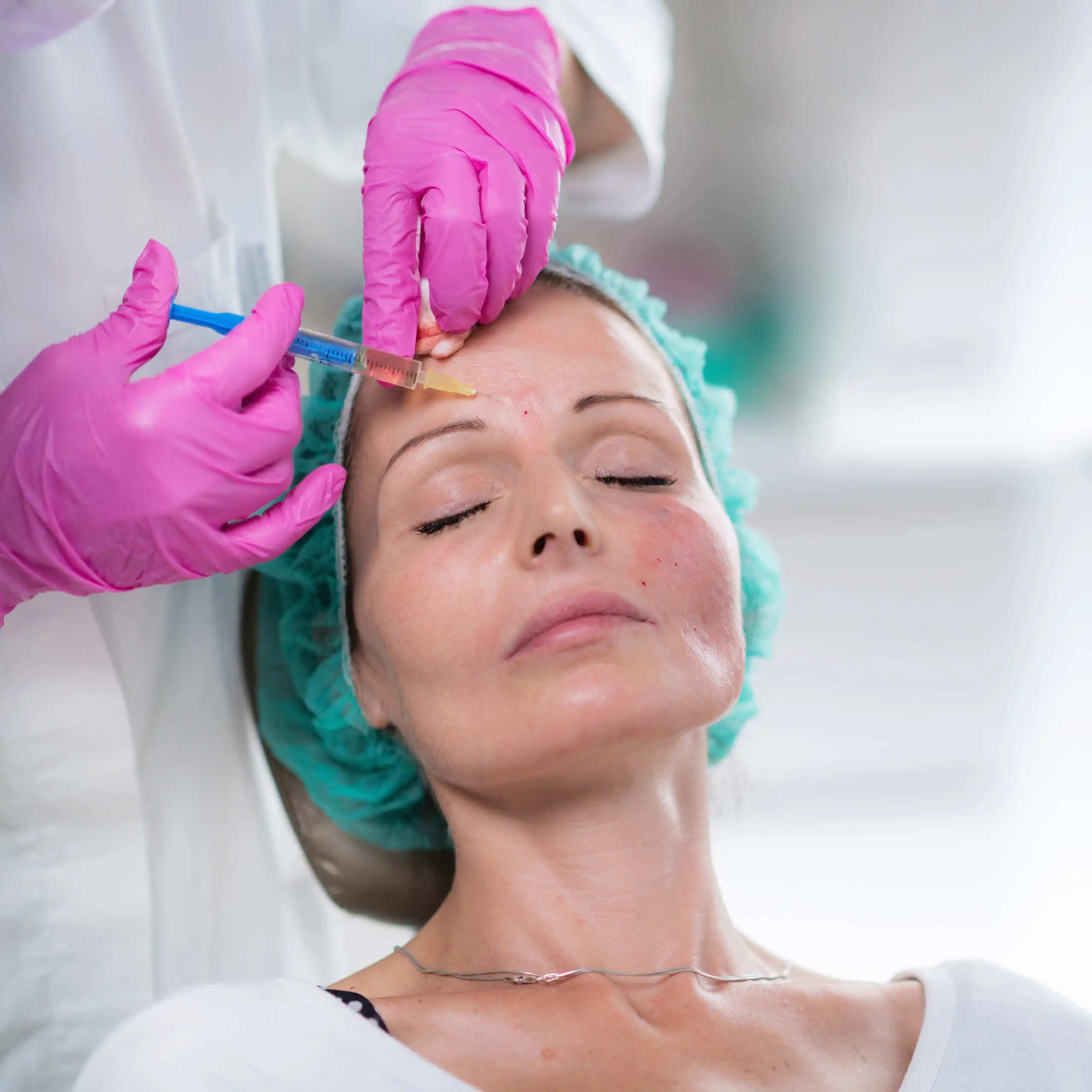 Wrinkle Relaxation Injections (Botox): Guide to Smoother, Youthful Skin