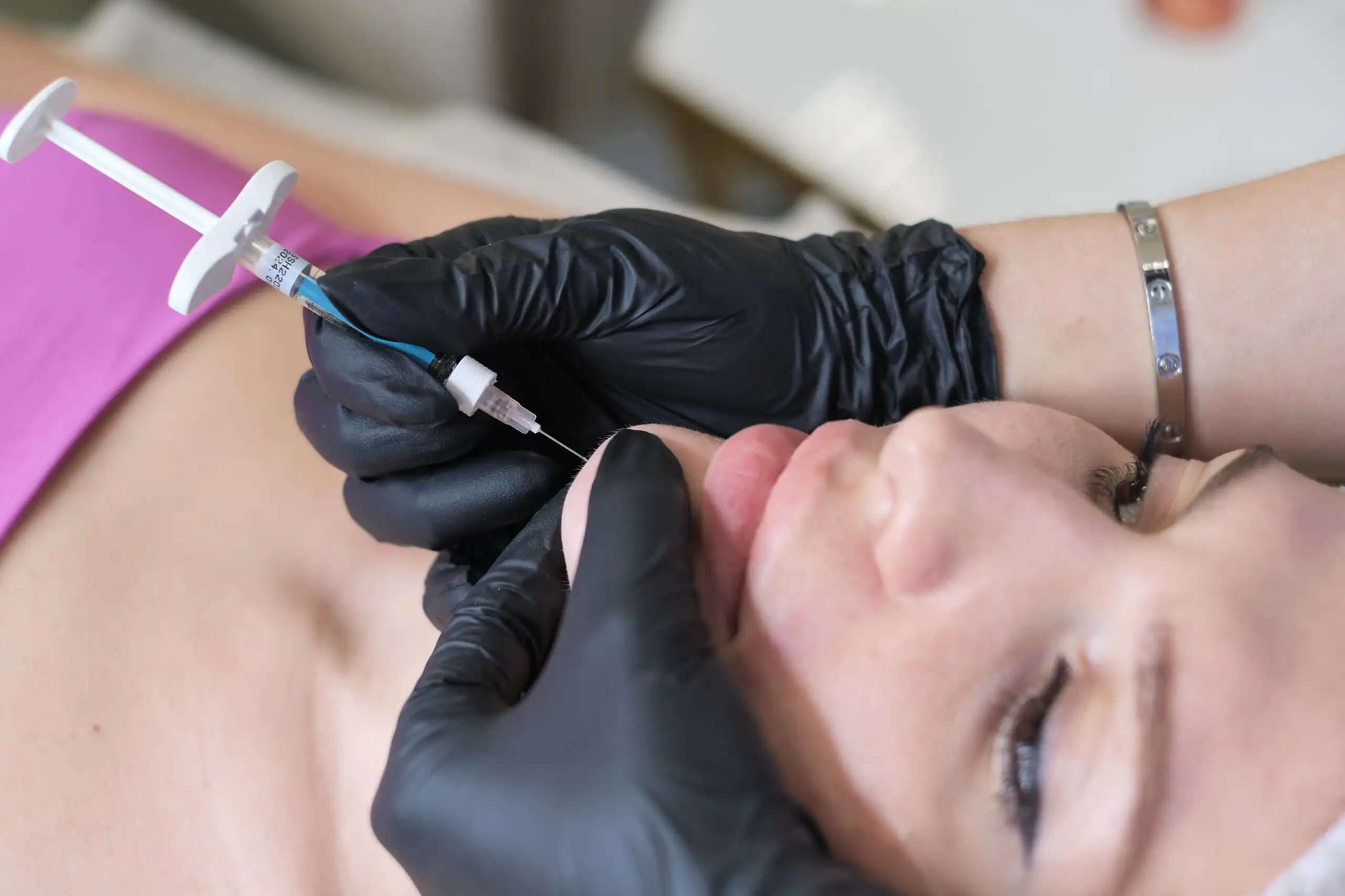 Wrinkle Relaxation Procedure